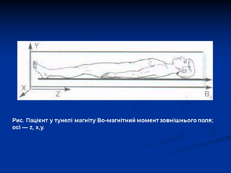 Рис. Пацієнт у тунелі магніту Во-магнітний момент зовнішнього поля;  осі — z, х,у.